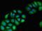 VPS39 Subunit Of HOPS Complex antibody, CSB-PA836235LA01HU, Cusabio, Immunofluorescence image 
