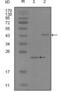 EPH Receptor A8 antibody, abx011927, Abbexa, Enzyme Linked Immunosorbent Assay image 