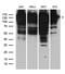 Epidermal Growth Factor Receptor Pathway Substrate 15 antibody, LS-C796632, Lifespan Biosciences, Western Blot image 