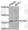 Caudal Type Homeobox 2 antibody, A1629, ABclonal Technology, Western Blot image 