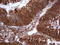 Galectin 9 antibody, LS-C790672, Lifespan Biosciences, Immunohistochemistry paraffin image 