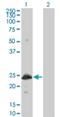 Heat Shock Protein Family B (Small) Member 8 antibody, H00026353-M03, Novus Biologicals, Western Blot image 