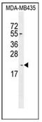 Killin, P53 Regulated DNA Replication Inhibitor antibody, AP52369PU-N, Origene, Western Blot image 