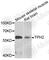 Tryptophan Hydroxylase 2 antibody, A7147, ABclonal Technology, Western Blot image 