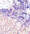SUZ12 Polycomb Repressive Complex 2 Subunit antibody, M00583-2, Boster Biological Technology, Immunohistochemistry paraffin image 