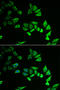 Myozenin 2 antibody, STJ28551, St John