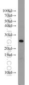 StAR Related Lipid Transfer Domain Containing 5 antibody, 10487-1-AP, Proteintech Group, Western Blot image 