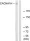 Calcium Voltage-Gated Channel Subunit Alpha1 H antibody, GTX87612, GeneTex, Western Blot image 