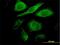 Cyclin Dependent Kinase 4 antibody, H00001019-M09, Novus Biologicals, Immunofluorescence image 