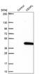 Centromere Protein L antibody, PA5-60736, Invitrogen Antibodies, Western Blot image 