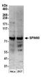 WASP-interacting SH3-domain protein antibody, A302-647A, Bethyl Labs, Western Blot image 