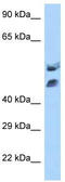 Homeobox A13 antibody, TA329714, Origene, Western Blot image 