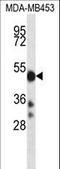 Cytochrome P450 Family 2 Subfamily D Member 6 antibody, LS-C167225, Lifespan Biosciences, Western Blot image 