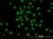 GATA Binding Protein 2 antibody, H00002624-M05, Novus Biologicals, Immunocytochemistry image 