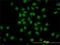 GATA Binding Protein 2 antibody, H00002624-M05, Novus Biologicals, Immunocytochemistry image 