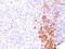 TNF Receptor Superfamily Member 8 antibody, NBP2-48313, Novus Biologicals, Immunohistochemistry paraffin image 