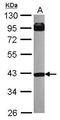 Inositol Polyphosphate-5-Phosphatase A antibody, GTX104929, GeneTex, Western Blot image 