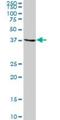 OXA1L Mitochondrial Inner Membrane Protein antibody, H00005018-B03P, Novus Biologicals, Western Blot image 