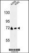 Glutamine-Fructose-6-Phosphate Transaminase 2 antibody, 63-873, ProSci, Western Blot image 