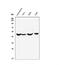 Endothelin Receptor Type B antibody, M01041-1, Boster Biological Technology, Western Blot image 