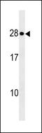 KDEL Endoplasmic Reticulum Protein Retention Receptor 1 antibody, LS-C159985, Lifespan Biosciences, Western Blot image 