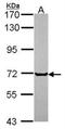 GHBP antibody, NBP1-31420, Novus Biologicals, Western Blot image 