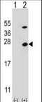 ATP Synthase Peripheral Stalk Subunit OSCP antibody, LS-B9288, Lifespan Biosciences, Western Blot image 
