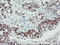 p53 antibody, LS-C172911, Lifespan Biosciences, Immunohistochemistry paraffin image 