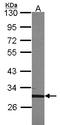 rTFEC antibody, LS-C185660, Lifespan Biosciences, Western Blot image 