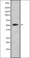 Solute Carrier Family 7 Member 5 antibody, orb337011, Biorbyt, Western Blot image 