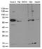 Forkhead Box O1 antibody, LS-C795593, Lifespan Biosciences, Western Blot image 