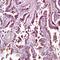 Phospholipase A And Acyltransferase 3 antibody, orb13480, Biorbyt, Immunohistochemistry paraffin image 