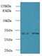 NmrA Like Redox Sensor 1 antibody, A60046-100, Epigentek, Western Blot image 
