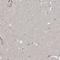 Ribokinase antibody, HPA028285, Atlas Antibodies, Immunohistochemistry frozen image 