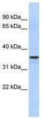 Transcriptional Adaptor 2A antibody, TA335196, Origene, Western Blot image 