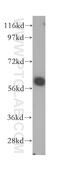 Solute Carrier Family 38 Member 3 antibody, 14315-1-AP, Proteintech Group, Western Blot image 