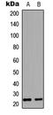 Endothelin 1 antibody, LS-C356007, Lifespan Biosciences, Western Blot image 