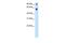 TATA-Box Binding Protein Associated Factor 15 antibody, GTX77901, GeneTex, Western Blot image 