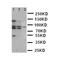 ATP-binding cassette sub-family B member 6, mitochondrial antibody, orb76236, Biorbyt, Western Blot image 