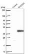 Exosome Component 8 antibody, NBP2-47466, Novus Biologicals, Western Blot image 