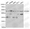 Potassium Calcium-Activated Channel Subfamily N Member 4 antibody, A1974, ABclonal Technology, Western Blot image 