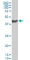 Pyruvate Dehydrogenase Kinase 3 antibody, H00005165-M02, Novus Biologicals, Western Blot image 