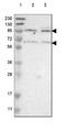 Cadherin 18 antibody, NBP2-48527, Novus Biologicals, Western Blot image 