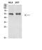 Tubulin alpha-1A chain antibody, STJ98948, St John