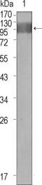 Fms Related Tyrosine Kinase 1 antibody, MA5-15550, Invitrogen Antibodies, Western Blot image 
