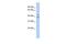 Harbinger Transposase Derived 1 antibody, GTX45217, GeneTex, Western Blot image 