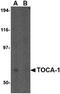 Formin Binding Protein 1 Like antibody, PA5-20445, Invitrogen Antibodies, Western Blot image 