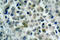 Histone Deacetylase 8 antibody, LS-C176062, Lifespan Biosciences, Immunohistochemistry paraffin image 