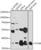 FosB Proto-Oncogene, AP-1 Transcription Factor Subunit antibody, 15-671, ProSci, Western Blot image 