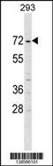 ZFP69 Zinc Finger Protein B antibody, 59-998, ProSci, Western Blot image 